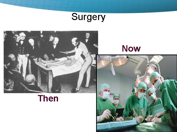 Surgery Now Then 