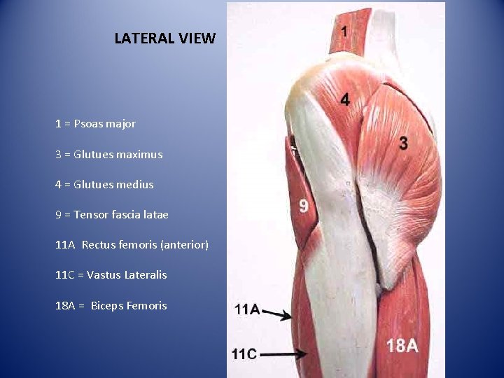 LATERAL VIEW 1 = Psoas major 3 = Glutues maximus 4 = Glutues medius