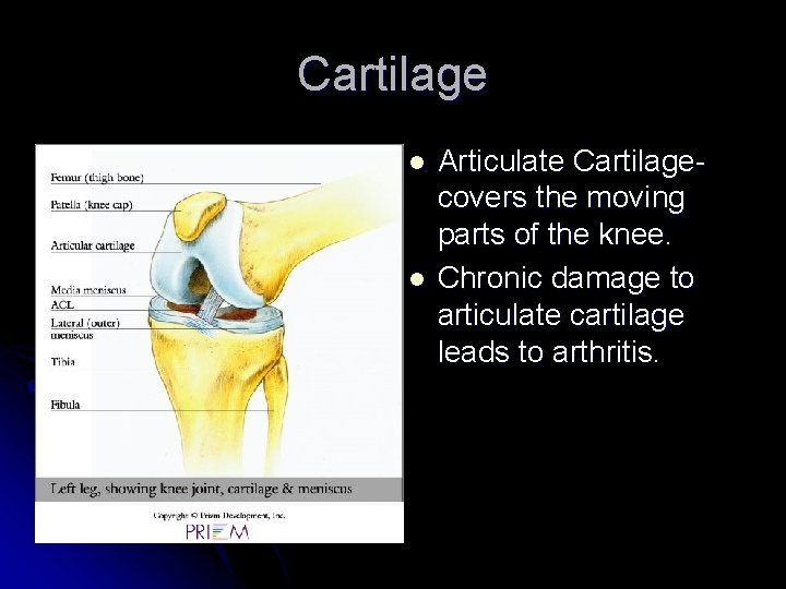 Cartilage l l Articulate Cartilagecovers the moving parts of the knee. Chronic damage to