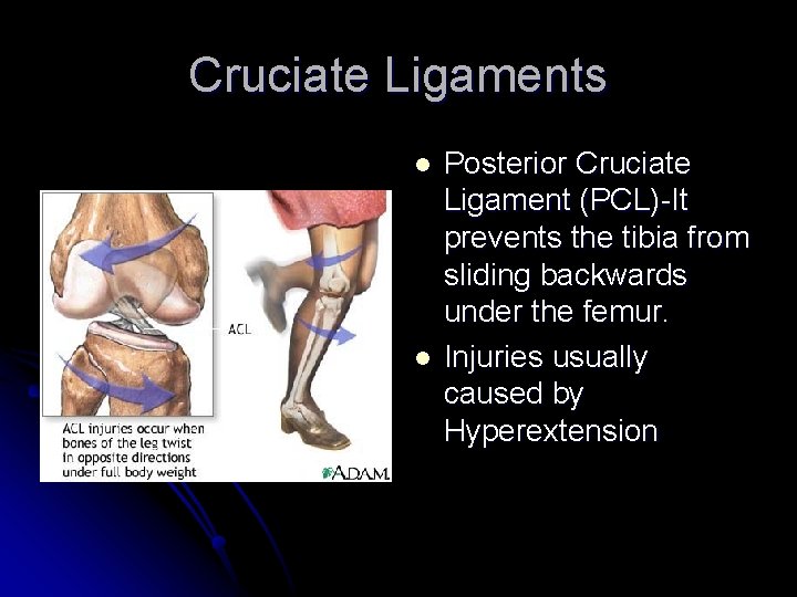 Cruciate Ligaments l l Posterior Cruciate Ligament (PCL)-It prevents the tibia from sliding backwards