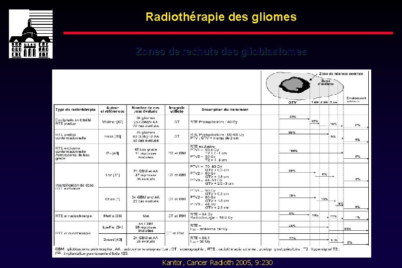 Radiothérapie des gliomes Zones de rechute des glioblastomes Kantor, Cancer Radioth 2005, 9: 230