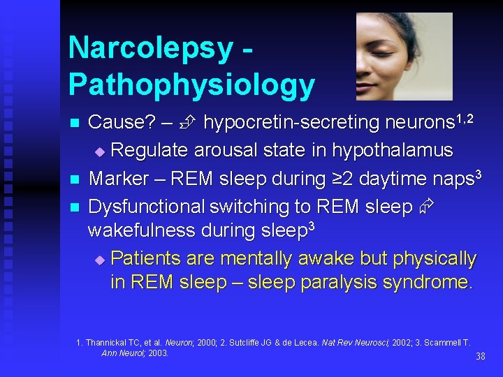 Narcolepsy Pathophysiology n n n Cause? – hypocretin-secreting neurons 1, 2 u Regulate arousal