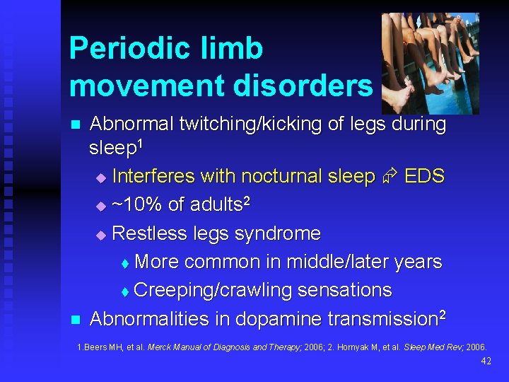 Periodic limb movement disorders n n Abnormal twitching/kicking of legs during sleep 1 u
