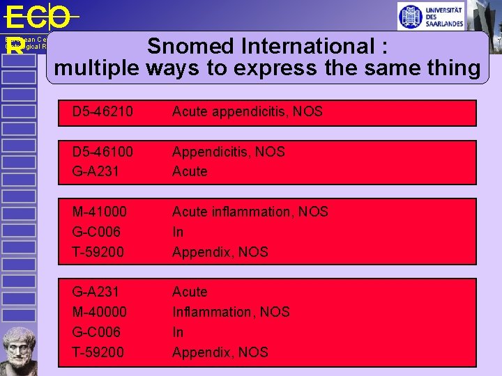 ECO R Snomed International : multiple ways to express the same thing European Centre