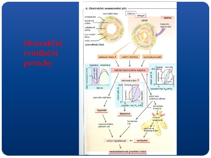 Obstrukční ventilační poruchy 