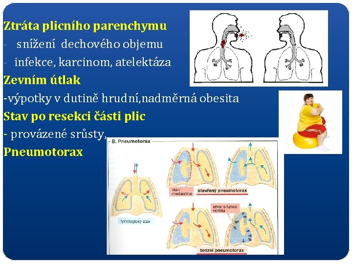 Ztráta plicního parenchymu - snížení dechového objemu - infekce, karcinom, atelektáza Zevním útlak -výpotky