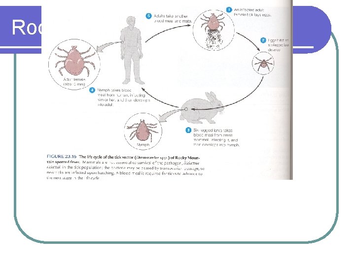 Rocky mountain spotted fever 