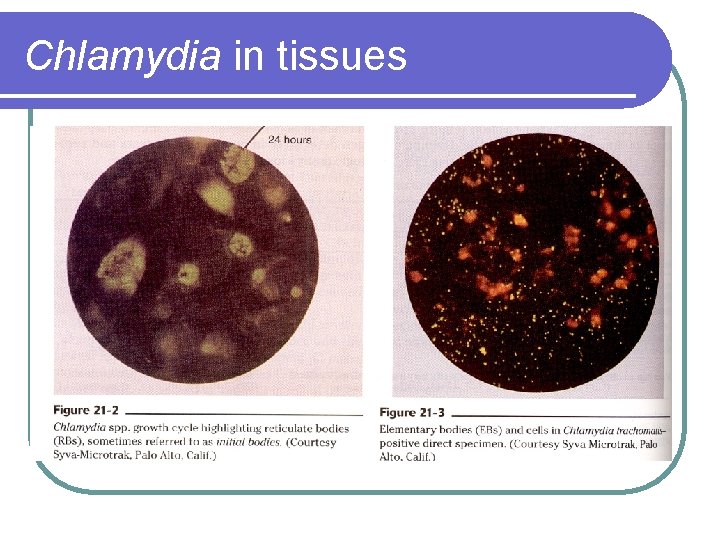 Chlamydia in tissues 