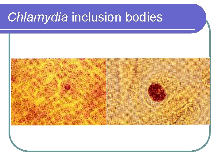 Chlamydia inclusion bodies 