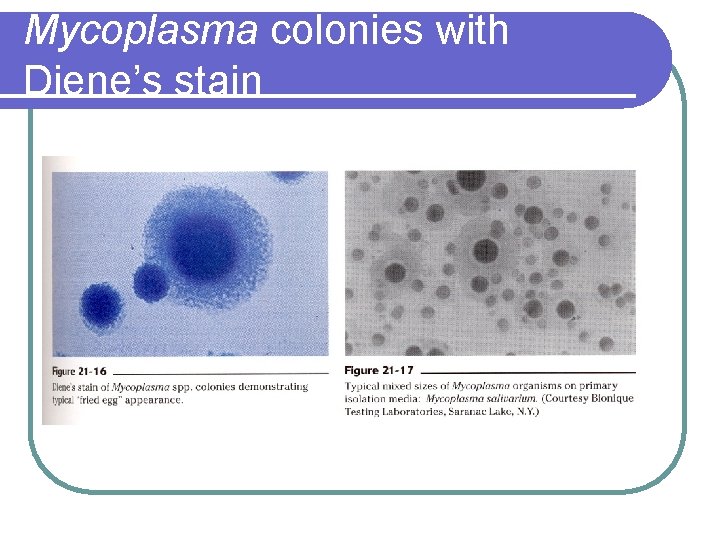 Mycoplasma colonies with Diene’s stain 