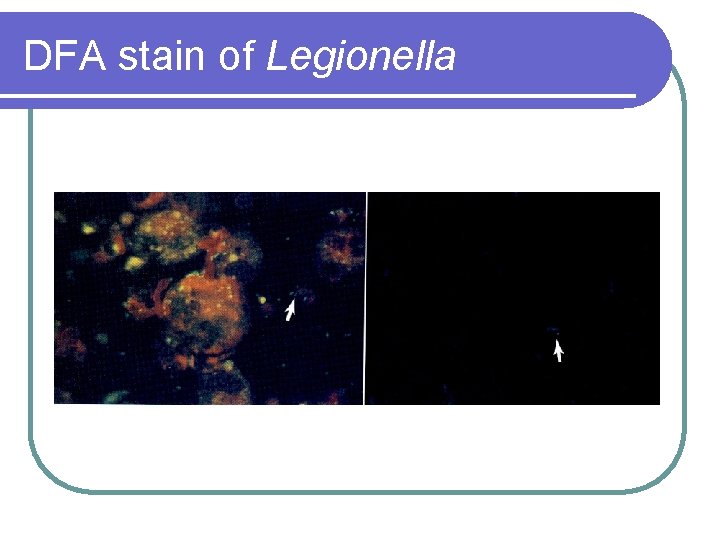 DFA stain of Legionella 