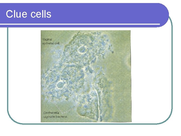 Clue cells 