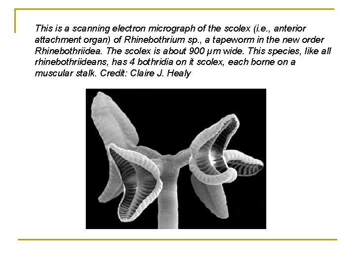 This is a scanning electron micrograph of the scolex (i. e. , anterior attachment