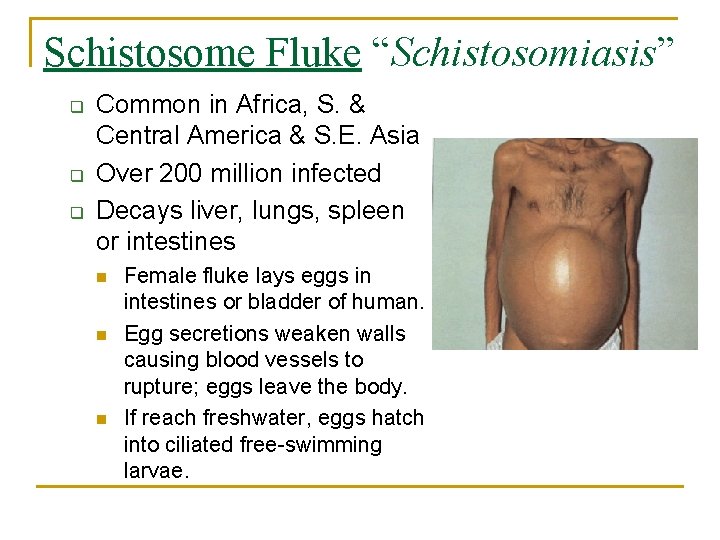 Schistosome Fluke “Schistosomiasis” q q q Common in Africa, S. & Central America &