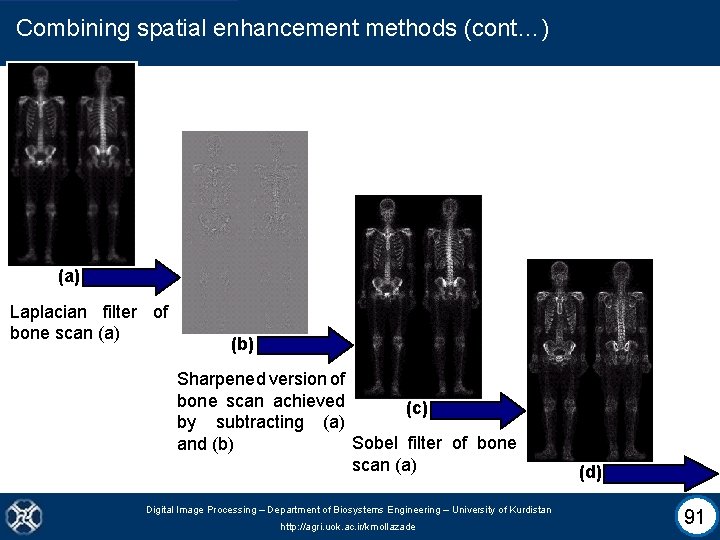 Combining spatial enhancement methods (cont…) (a) Laplacian filter of bone scan (a) (b) Sharpened