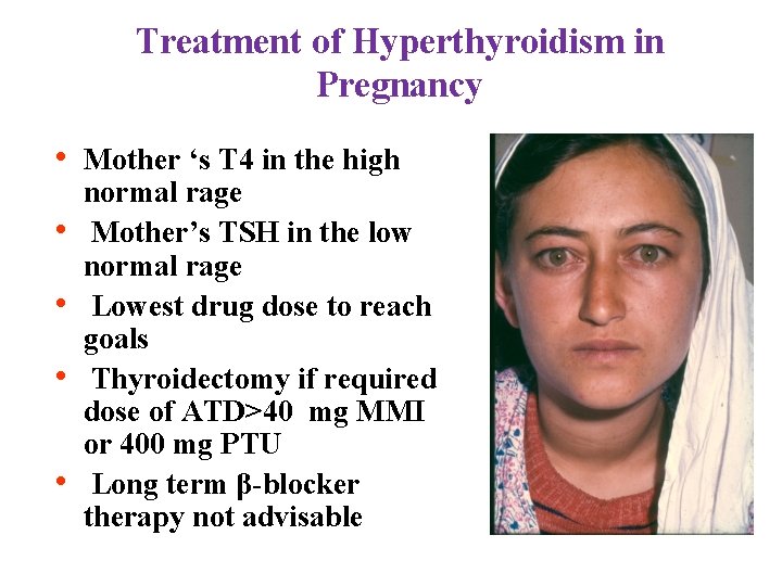 Treatment of Hyperthyroidism in Pregnancy • Mother ‘s T 4 in the high •