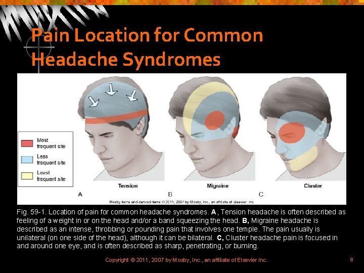 Pain Location for Common Headache Syndromes Fig. 59 -1. Location of pain for common
