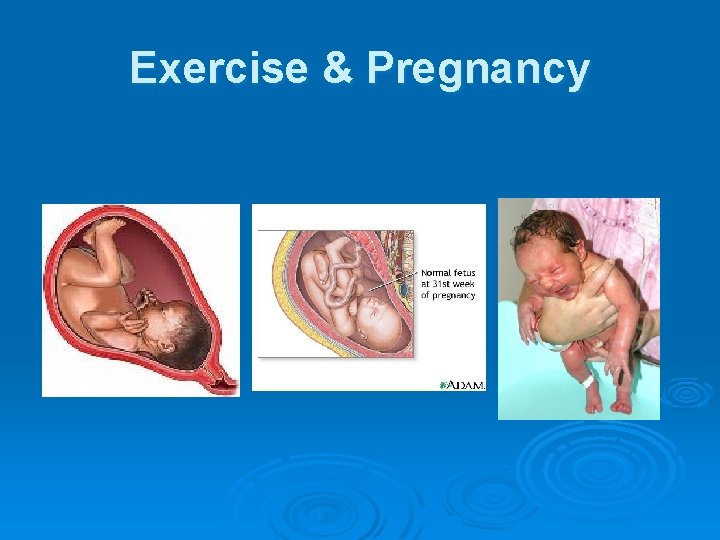 Exercise & Pregnancy 