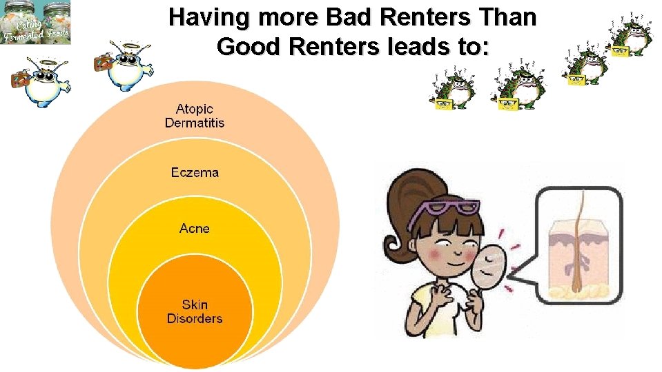 Having more Bad Renters Than Good Renters leads to: 