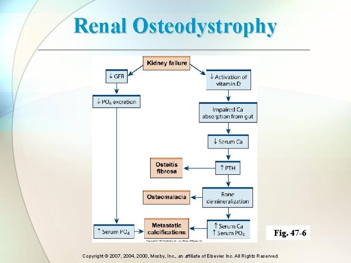 Renal Osteodystrophy Fig. 47 -6 Copyright © 2007, 2004, 2000, Mosby, Inc. , an Renal Osteodystrophy Fig. 47 -6 Copyright © 2007, 2004, 2000, Mosby, Inc. , an