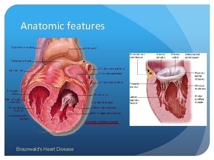 Anatomic features Braunwald's Heart Disease 