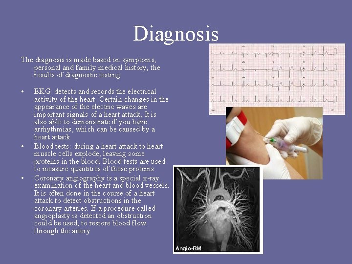 Diagnosis The diagnosis is made based on symptoms, personal and family medical history, the Diagnosis The diagnosis is made based on symptoms, personal and family medical history, the