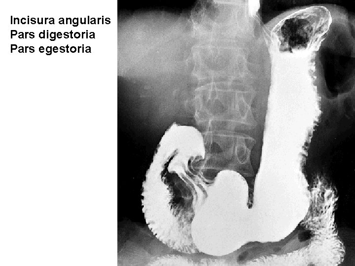 Incisura angularis Pars digestoria Pars egestoria 