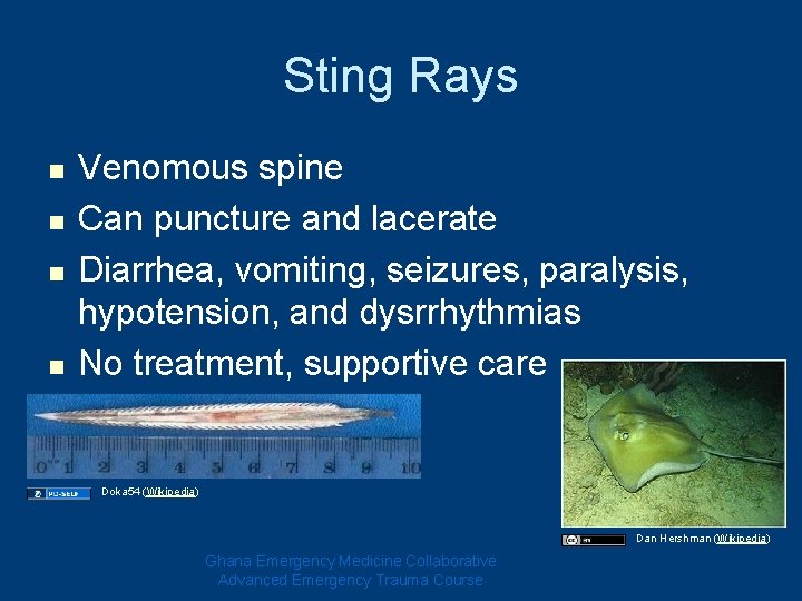 Sting Rays n n Venomous spine Can puncture and lacerate Diarrhea, vomiting, seizures, paralysis, Sting Rays n n Venomous spine Can puncture and lacerate Diarrhea, vomiting, seizures, paralysis,
