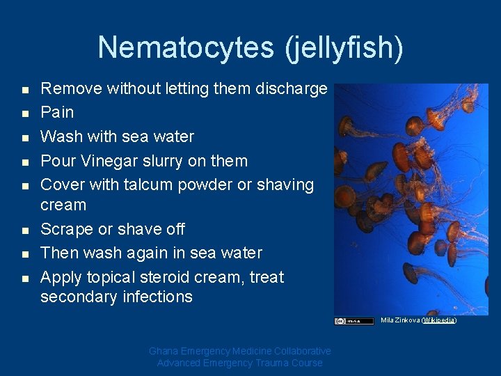 Nematocytes (jellyfish) n n n n Remove without letting them discharge Pain Wash with Nematocytes (jellyfish) n n n n Remove without letting them discharge Pain Wash with
