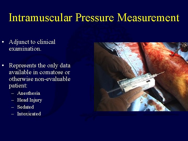 Intramuscular Pressure Measurement • Adjunct to clinical examination. • Represents the only data available