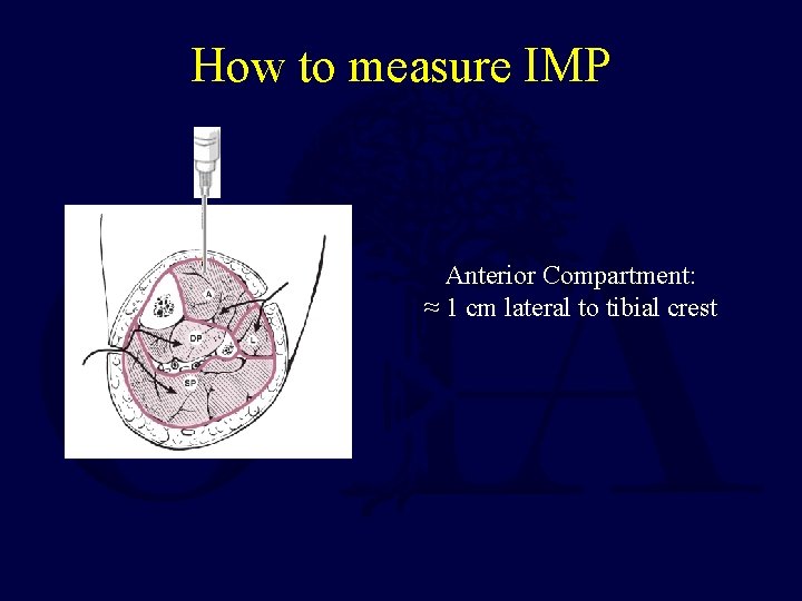 How to measure IMP Anterior Compartment: ≈ 1 cm lateral to tibial crest 