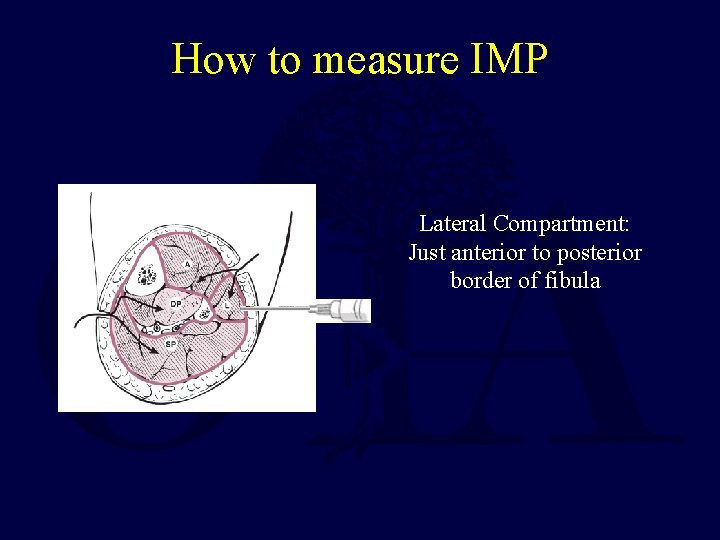 How to measure IMP Lateral Compartment: Just anterior to posterior border of fibula 