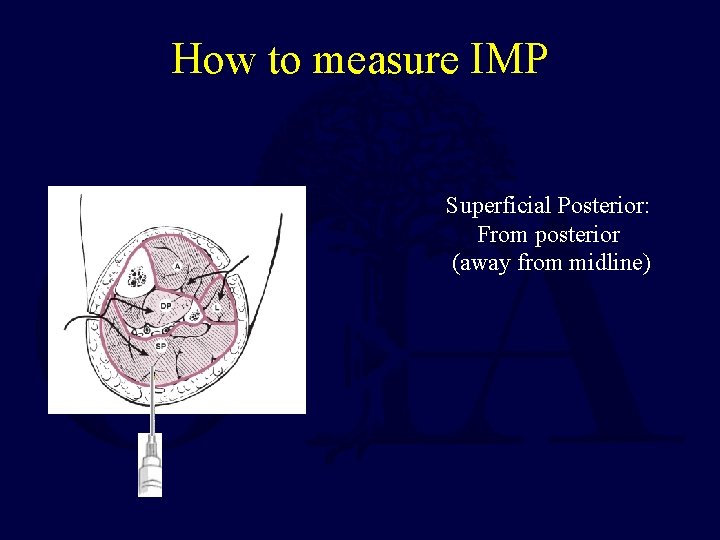 How to measure IMP Superficial Posterior: From posterior (away from midline) 
