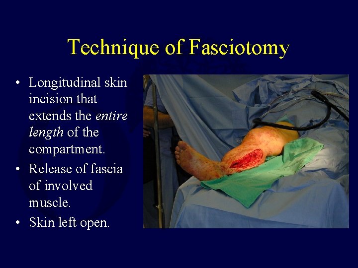 Technique of Fasciotomy • Longitudinal skin incision that extends the entire length of the