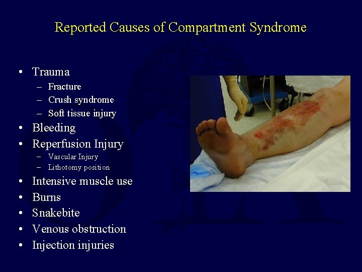 Reported Causes of Compartment Syndrome • Trauma – Fracture – Crush syndrome – Soft