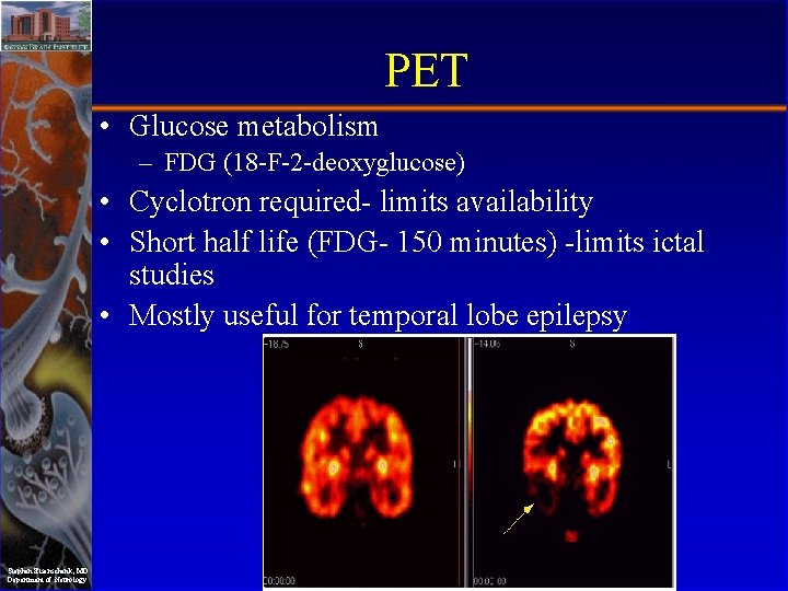 PET • Glucose metabolism – FDG (18 -F-2 -deoxyglucose) • Cyclotron required- limits availability