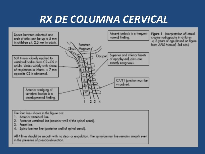 RX DE COLUMNA CERVICAL 