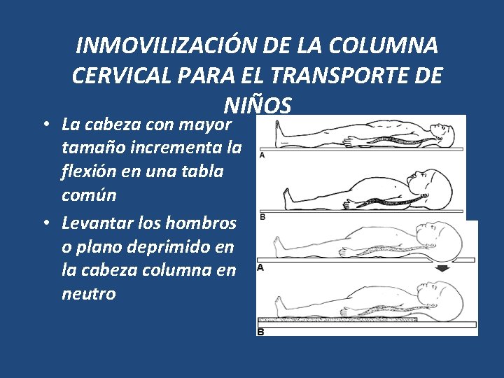 INMOVILIZACIÓN DE LA COLUMNA CERVICAL PARA EL TRANSPORTE DE NIÑOS • La cabeza con