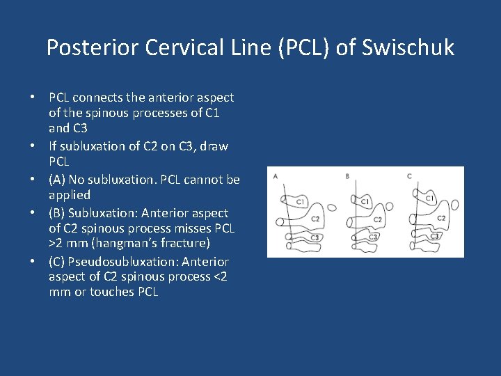 Posterior Cervical Line (PCL) of Swischuk • PCL connects the anterior aspect of the