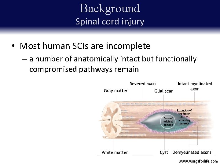 Background Spinal cord injury • • Most Inflammation Loss of human electrical SCIs andsignal