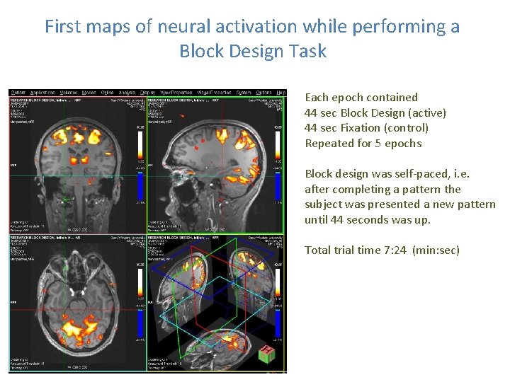 First maps of neural activation while performing a Block Design Task Each epoch contained