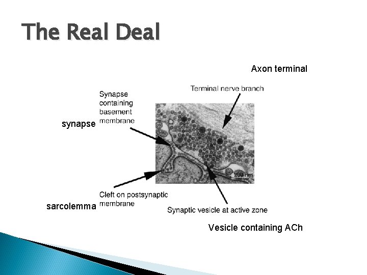 The Real Deal Axon terminal synapse sarcolemma Vesicle containing ACh 