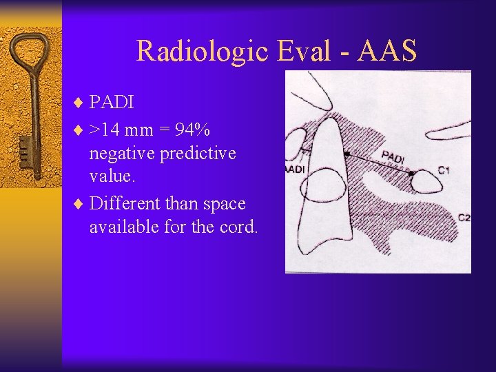 Radiologic Eval - AAS ¨ PADI ¨ >14 mm = 94% negative predictive value.