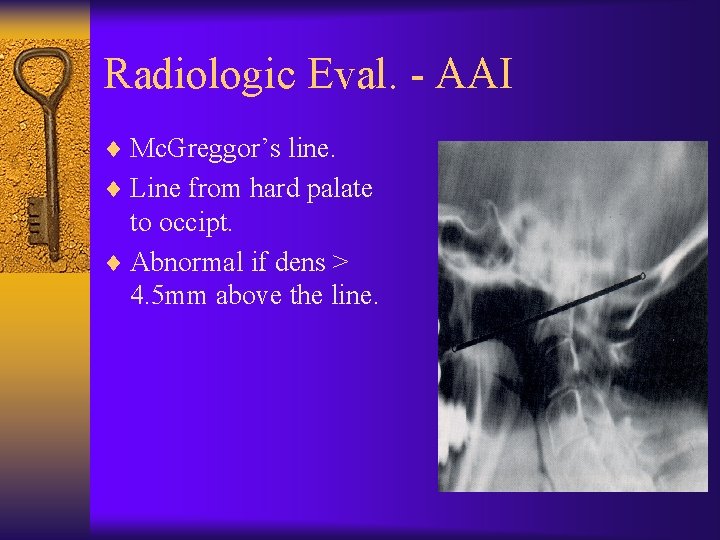Radiologic Eval. - AAI ¨ Mc. Greggor’s line. ¨ Line from hard palate to