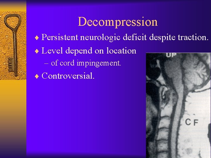 Decompression ¨ Persistent neurologic deficit despite traction. ¨ Level depend on location – of