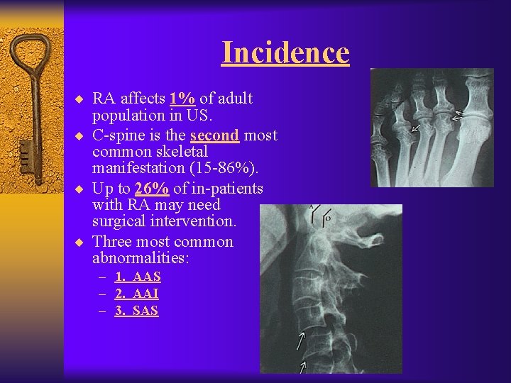 Incidence ¨ RA affects 1% of adult population in US. ¨ C-spine is the