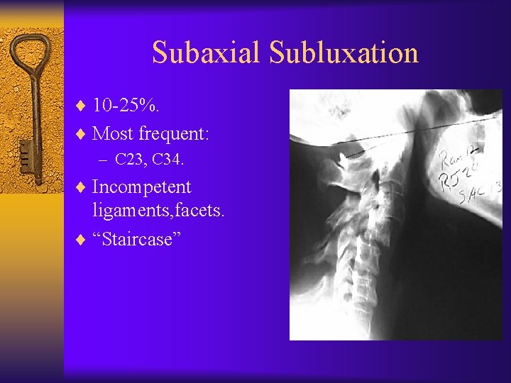 Subaxial Subluxation ¨ 10 -25%. ¨ Most frequent: – C 23, C 34. ¨