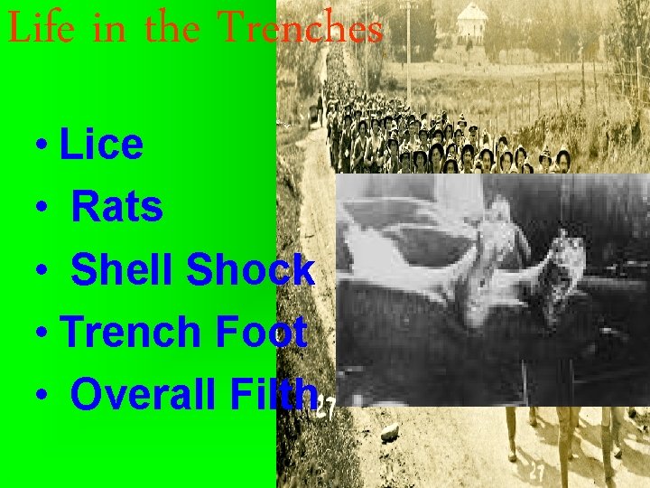 Life in the Trenches • Lice • Rats • Shell Shock • Trench Foot