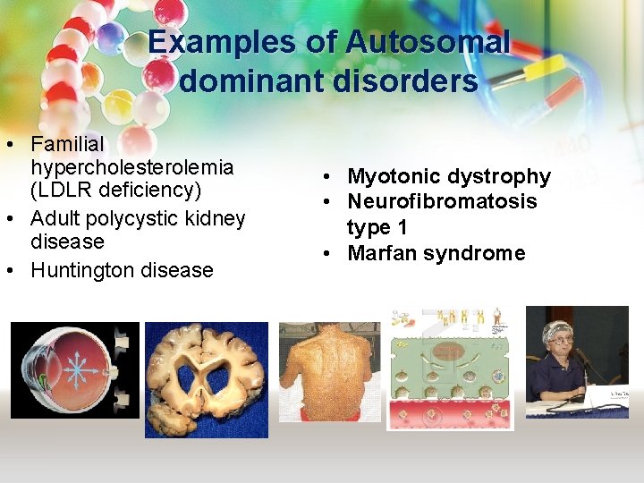 Examples of Autosomal dominant disorders • Familial hypercholesterolemia (LDLR deficiency) • Adult polycystic kidney