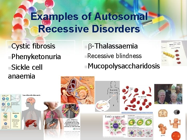 Examples of Autosomal Recessive Disorders Cystic fibrosis n. Phenyketonuria n. Sickle cell anaemia n